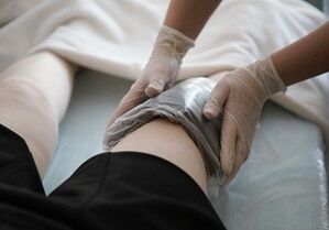 therapeutic compresses for arthritis and arthrosis