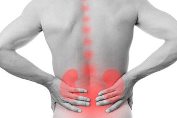 Kidney pathology can trigger the appearance of lower back pain