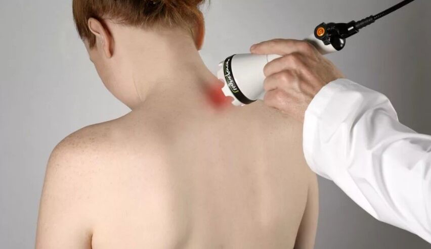 Physiotherapy method for treating cervical osteochondrosis