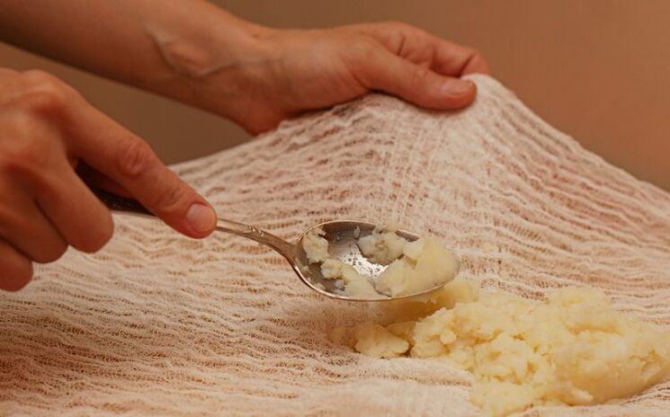 The preparation of compresses from potatoes