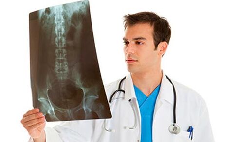 Doctors look at X-rays to diagnose low back pain